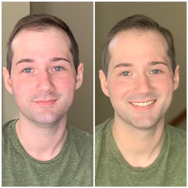 before and after male natural makeup